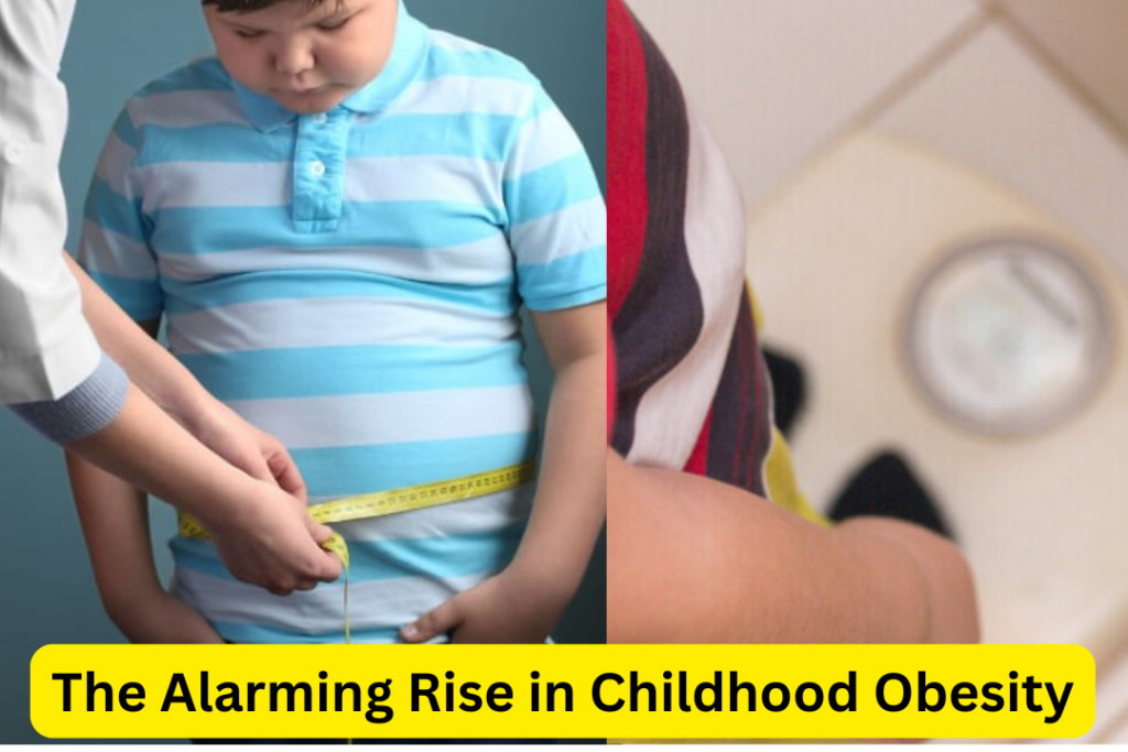 The Alarming Rise in Childhood Obesity